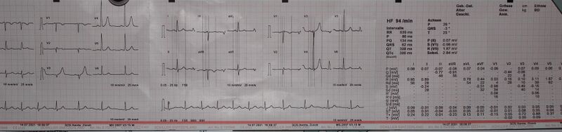 Datei:EKG.JPG